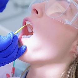 Dentist applying fluoride to child’s teeth