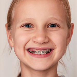 A girl with interceptive orthodontics